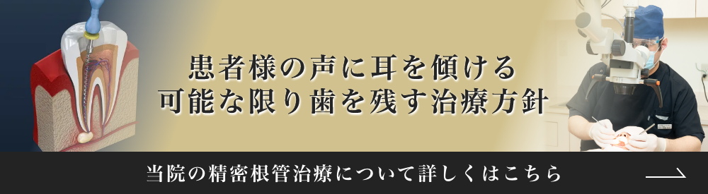 精密根管治療